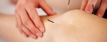 Dry Needling & Electronic muscle stimulation (EMS) - Bawn Holistic Therapies